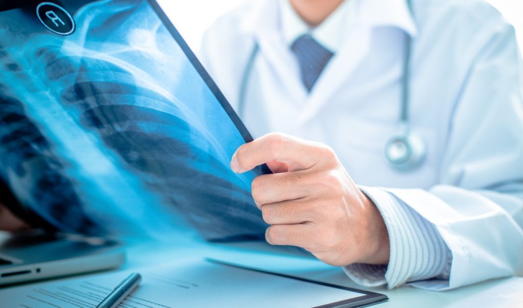 How to a Radiologist The Money Alert